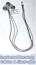 Implanted receiver, cables and electrodes.