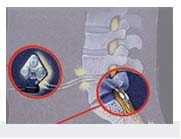 Diagram showing the wiring to the vertebrae